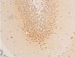 Phospho-Survivin (Thr117) Antibody in Immunohistochemistry (Paraffin) (IHC (P))