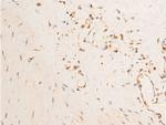 Phospho-PDPK1 (Ser241) Antibody in Immunohistochemistry (Paraffin) (IHC (P))