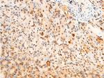 Phospho-PDPK1 (Ser241) Antibody in Immunohistochemistry (Paraffin) (IHC (P))