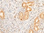 Phospho-PDPK1 (Ser241) Antibody in Immunohistochemistry (Paraffin) (IHC (P))