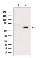 Phospho-PDPK1 (Ser241) Antibody in Western Blot (WB)