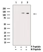 Phospho-JAK2 (Tyr570) Antibody in Western Blot (WB)