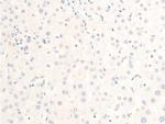 Phospho-MiTF (Ser180) Antibody in Immunohistochemistry (Paraffin) (IHC (P))