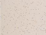 Phospho-MiTF (Ser180) Antibody in Immunohistochemistry (Paraffin) (IHC (P))