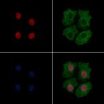 Phospho-SNAIL (Ser246) Antibody in Immunocytochemistry (ICC/IF)