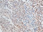 Phospho-Chk2 (Thr387) Antibody in Immunohistochemistry (Paraffin) (IHC (P))