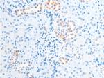 Phospho-Chk2 (Thr387) Antibody in Immunohistochemistry (Paraffin) (IHC (P))