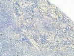 Phospho-Chk2 (Thr68) Antibody in Immunohistochemistry (Paraffin) (IHC (P))