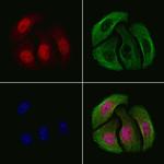 Phospho-Chk2 (Thr68) Antibody in Immunocytochemistry (ICC/IF)