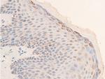 Phospho-Chk2 (Thr68) Antibody in Immunohistochemistry (Paraffin) (IHC (P))