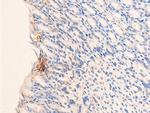 Phospho-Chk2 (Thr68) Antibody in Immunohistochemistry (Paraffin) (IHC (P))