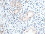 Phospho-Chk2 (Thr68) Antibody in Immunohistochemistry (Paraffin) (IHC (P))