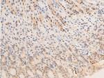 Phospho-EGFR (Ser1071) Antibody in Immunohistochemistry (Paraffin) (IHC (P))