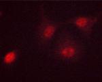 Phospho-c-Myc (Ser62) Antibody in Immunocytochemistry (ICC/IF)