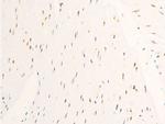 Phospho-c-Myc (Ser62) Antibody in Immunohistochemistry (Paraffin) (IHC (P))