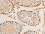 Phospho-c-Myc (Ser62) Antibody in Immunohistochemistry (Paraffin) (IHC (P))