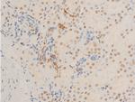 Phospho-c-Myc (Ser62) Antibody in Immunohistochemistry (Paraffin) (IHC (P))