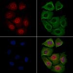 Phospho-c-Myc (Thr58) Antibody in Immunocytochemistry (ICC/IF)