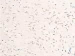 Phospho-c-Myc (Thr58) Antibody in Immunohistochemistry (Paraffin) (IHC (P))