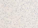 Phospho-c-Myc (Thr58) Antibody in Immunohistochemistry (Paraffin) (IHC (P))