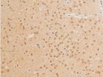 Phospho-c-Myc (Thr58) Antibody in Immunohistochemistry (Paraffin) (IHC (P))