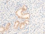 Phospho-c-Myc (Thr58) Antibody in Immunohistochemistry (Paraffin) (IHC (P))