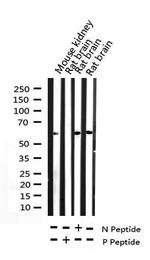 Phospho-c-Myc (Thr58) Antibody in Western Blot (WB)