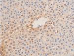 Phospho-Lamin A/C (Ser392) Antibody in Immunohistochemistry (Paraffin) (IHC (P))