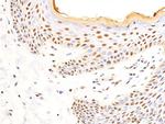 Phospho-Glucocorticoid Receptor (Ser226) Antibody in Immunohistochemistry (Paraffin) (IHC (P))