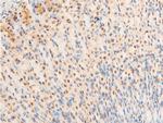 Phospho-Glucocorticoid Receptor (Ser226) Antibody in Immunohistochemistry (Paraffin) (IHC (P))