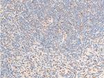 Phospho-Glucocorticoid Receptor (Ser226) Antibody in Immunohistochemistry (Paraffin) (IHC (P))