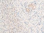 Phospho-Glucocorticoid Receptor (Ser226) Antibody in Immunohistochemistry (Paraffin) (IHC (P))