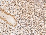 Phospho-Glucocorticoid Receptor (Ser203) Antibody in Immunohistochemistry (Paraffin) (IHC (P))