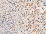 Phospho-Glucocorticoid Receptor (Ser203) Antibody in Immunohistochemistry (Paraffin) (IHC (P))