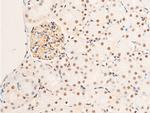 Phospho-Glucocorticoid Receptor (Ser203) Antibody in Immunohistochemistry (Paraffin) (IHC (P))