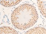 Phospho-Glucocorticoid Receptor (Ser203) Antibody in Immunohistochemistry (Paraffin) (IHC (P))