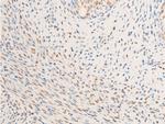 Phospho-Glucocorticoid Receptor (Ser203) Antibody in Immunohistochemistry (Paraffin) (IHC (P))