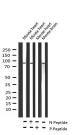 Phospho-Glucocorticoid Receptor (Ser203) Antibody in Western Blot (WB)