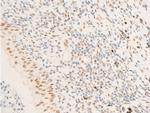 Phospho-TK1 (Ser13) Antibody in Immunohistochemistry (Paraffin) (IHC (P))