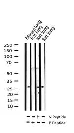 Phospho-TK1 (Ser13) Antibody in Western Blot (WB)