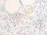 Phospho-ErbB2 (HER-2) (Tyr877) Antibody in Immunohistochemistry (Paraffin) (IHC (P))