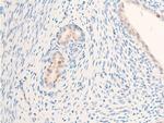 Phospho-ErbB2 (HER-2) (Tyr877) Antibody in Immunohistochemistry (Paraffin) (IHC (P))