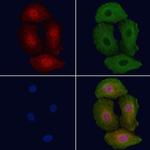 Phospho-ErbB2 (HER-2) (Tyr1112) Antibody in Immunocytochemistry (ICC/IF)