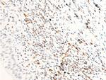 Phospho-ErbB2 (HER-2) (Tyr1112) Antibody in Immunohistochemistry (Paraffin) (IHC (P))