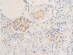 Phospho-ErbB2 (HER-2) (Tyr1112) Antibody in Immunohistochemistry (Paraffin) (IHC (P))