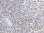 Phospho-ErbB2 (HER-2) (Tyr1112) Antibody in Immunohistochemistry (Paraffin) (IHC (P))