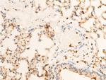 Phospho-TrkA (Tyr680, Tyr681) Antibody in Immunohistochemistry (Paraffin) (IHC (P))