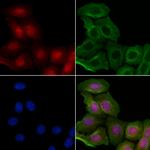 Phospho-p53 (Ser20) Antibody in Immunocytochemistry (ICC/IF)