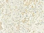 Phospho-p53 (Ser15) Antibody in Immunohistochemistry (Paraffin) (IHC (P))