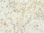 Phospho-p53 (Ser15) Antibody in Immunohistochemistry (Paraffin) (IHC (P))